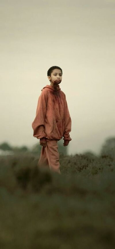 Young child with shaved head stands in isolated surrounds with blood around mouth